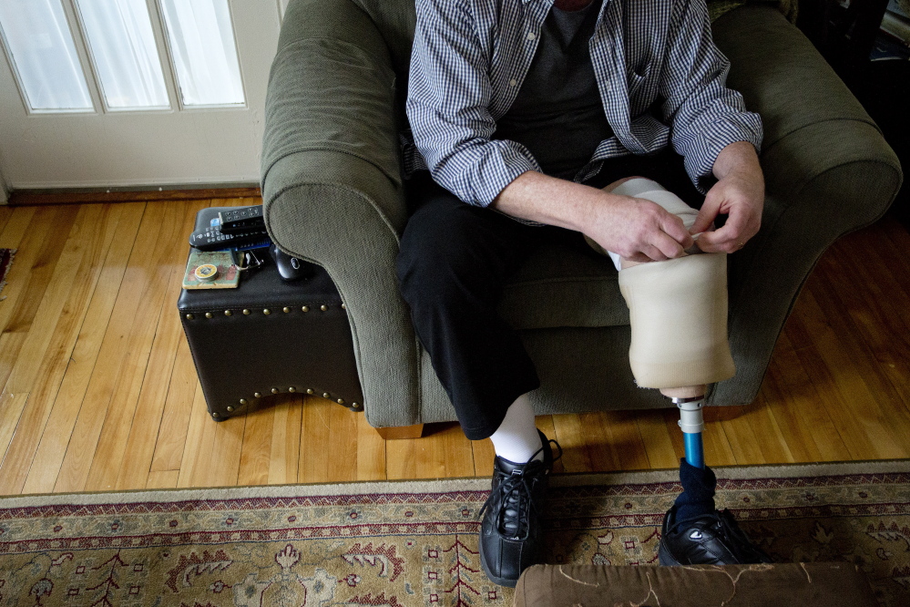 Tony Reilly of South Portland tucks back the layers of socks he wears with his prosthetic leg. He will return to the stage this week with “The Coma Monologues,” which he wrote while lying in a hospital bed after a Dec. 23 car accident that killed his wife, Susan.
