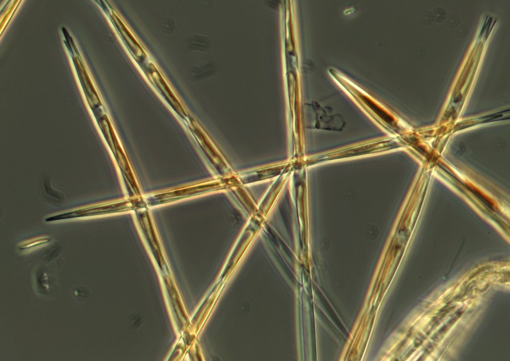 The algae pseudo-nitzchia produces toxic domoic acid.
The Associated Press