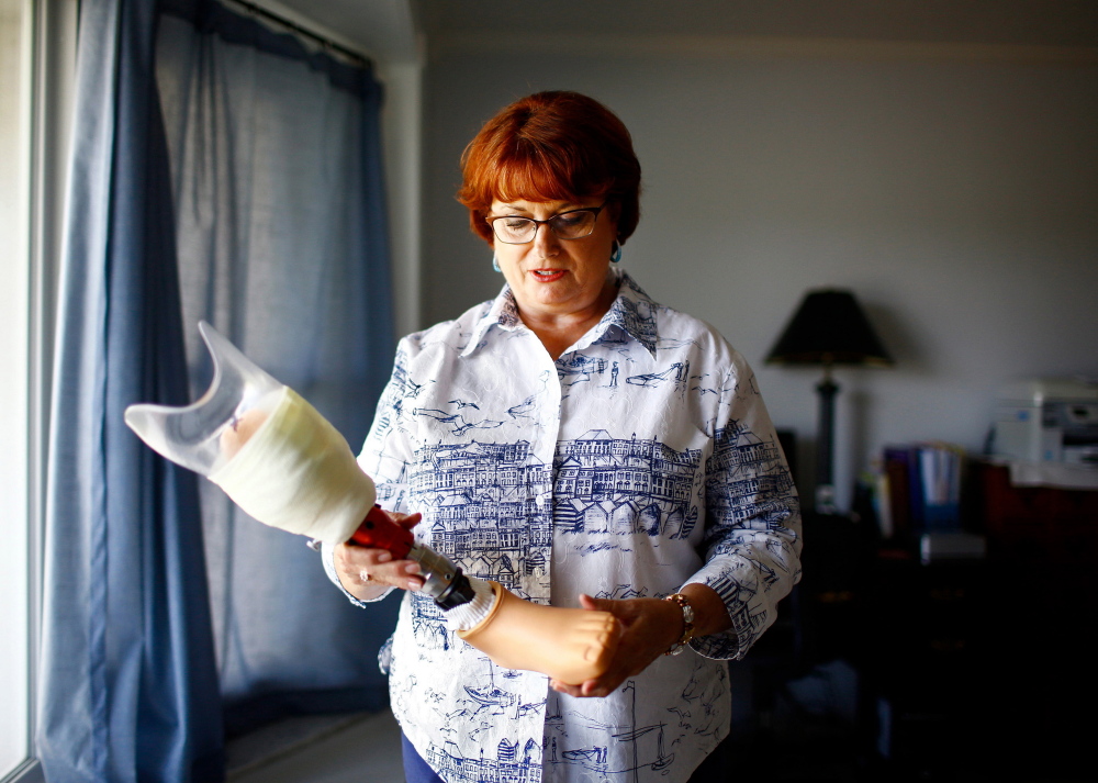 Army veteran Brenda Reed has not been able to be successfully fitted with a woman’s prosthetic foot since her left foot was amputated in 2013. Faced with a growing number of female veterans, the VA health system is struggling to provide not only customized prosthetics but also services such as prenatal care, mammograms and Pap tests.
