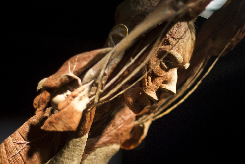 The “Body Worlds” exhibit uses a “plastination” procedure to reveal the insides of preserved bodies. A reader finds it surprising that more people are not outraged by it.
