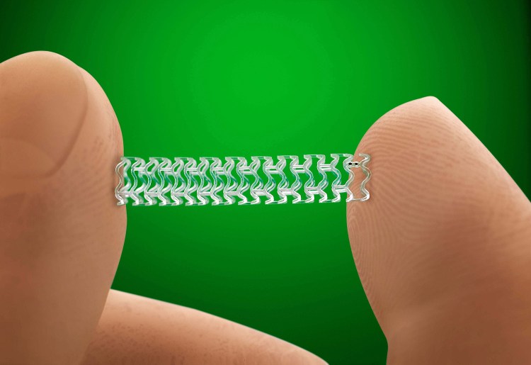 Abbott's experimental heart stent called Absorb. A study underway now of 5,000 patients is expected to help determine whether the stent's "promise will become a reality," writes Dr. Robert A. Byrne of the Technical University of Munich. Weinberg-Clark Photography/Abbott via AP
