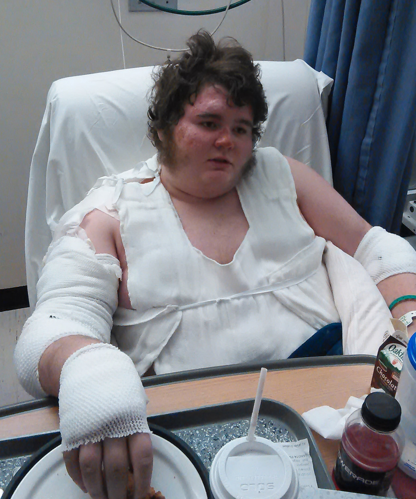 Dakota Pike, 15, at Maine Medical Center in Portland, recovers from second-degree burns suffered in fire at his home in Oakland early Saturday.