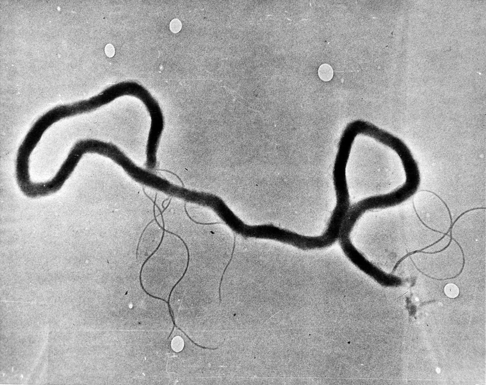The organism treponema pallidum, which causes syphilis, is seen through an electron microscope.