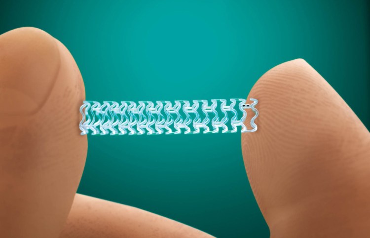 Absorb performed as well as a drug-coated metallic stent, also made by Abbott called Xience, in a human clinical trial of about 2,000 patients. But the study also found a slightly higher incidence of blood clotting, or thrombosis, in patients who received Absorb, which makes some cardiology researchers wary.