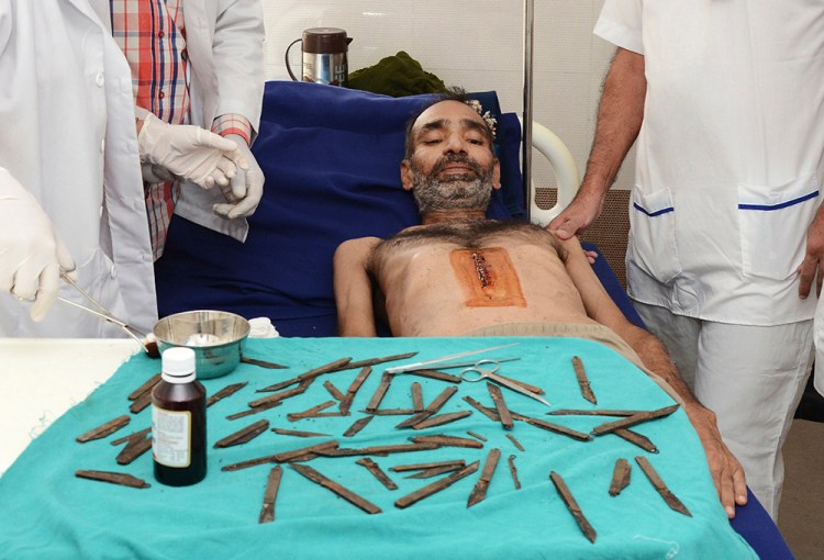 Police constable Surjeet Singh lies next to a table displaying the 40 knifes removed from his stomach as he recuperates in a hospital in Amritsar, India, Tuesday. Prabhjot Gill/Associated Press