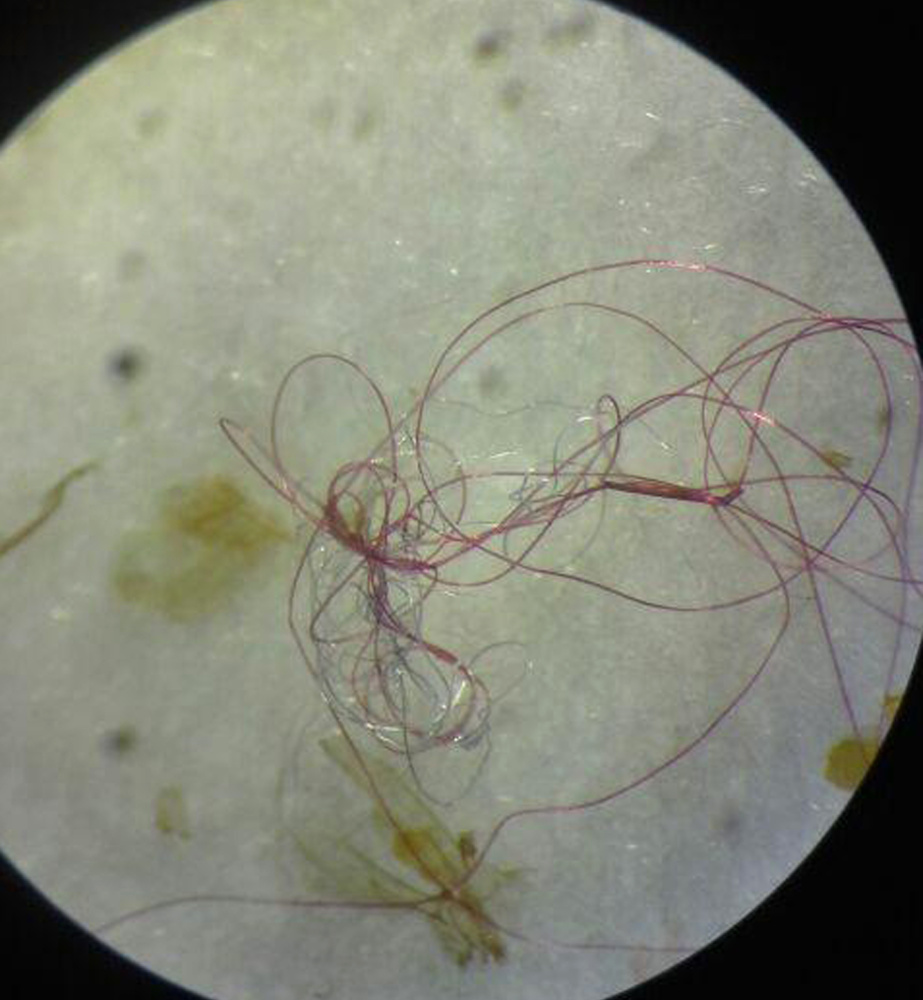 Microfibers taken from a fish in the Great Lakes are seen through a microscope. Scientists believe fish and other aquatic life are ingesting the bits of plastic, causing them to eat less and affecting their growth and survival. A 2011 study that found microfibers on shorelines around the world first uncovered the problem.
