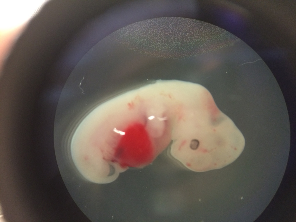 This undated photo shows a 4-week-old pig embryo which had been injected with human stem cells. The experiment was a very early step toward the possibility of growing human organs inside animals for transplantation.