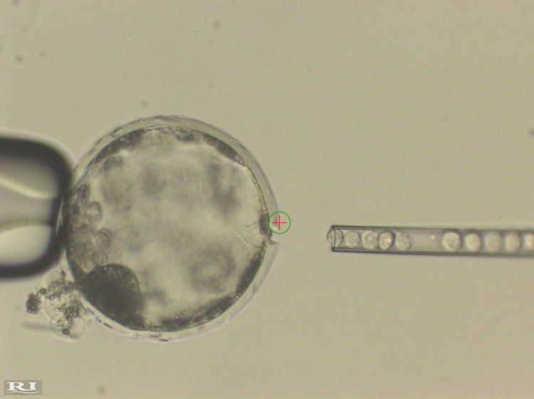 This undated photo shows the injection of human stem cells into a pig blastocyst. A laser beam, indicated by a green circle with a red cross inside, was used to perforate the outer membrane to allow easy access for the needle. The experiment was a very early step toward the possibility of growing human organs inside animals for transplantation.