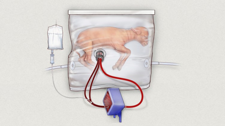 This illustration depicts a fluid-filled incubation system that mimics a mother's womb, in hopes of one day improving survival of extremely premature babies. In animal testing, fetal lambs grew for up to four weeks inside a bag filled with a substitute for amniotic fluid, while the heart pumped blood into a machine attached to the umbilical cord that supplied oxygen like a placenta normally would.