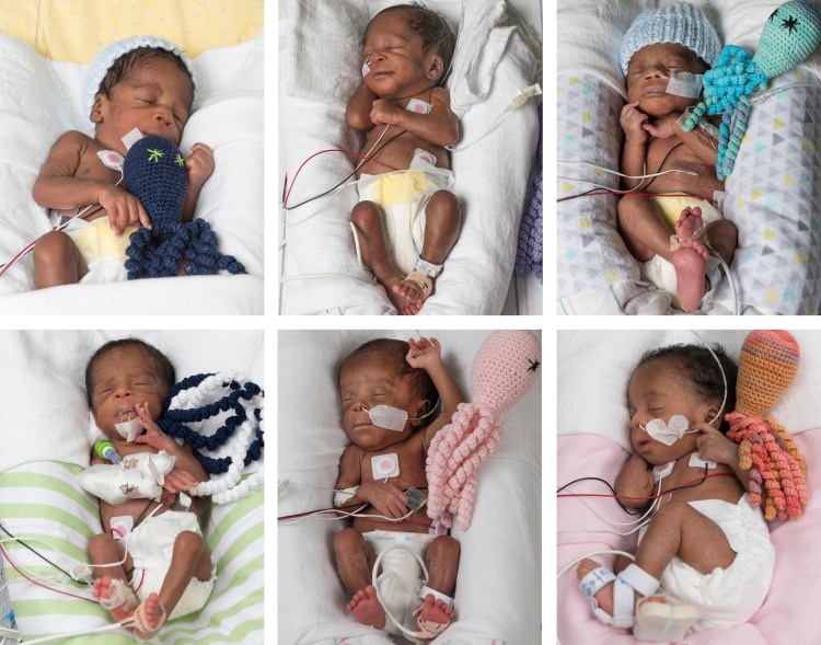 Sextuplets delivered at 30 weeks at VCU Medical Center in Richmond, Va.