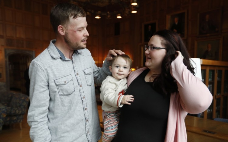 Lilly Ross, right, holds her 17-month-old son Leonard as she talks with face transplant recipient Andy Sandness, left, after their first meeting at the Mayo Clinic.