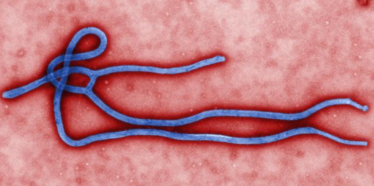 This photo provided by the Centers for Disease Control shows an Ebola virus. Telling scientists to avoid using scientific words won't protect us if there's another outbreak of the disease.