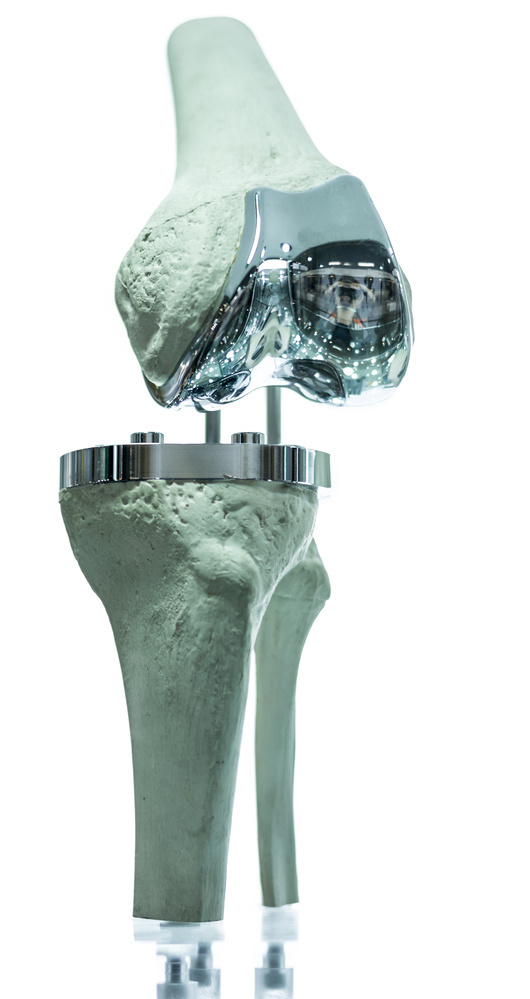 A knee prothesis is among the medical devices that will be taxed now following a two-year hiatus.