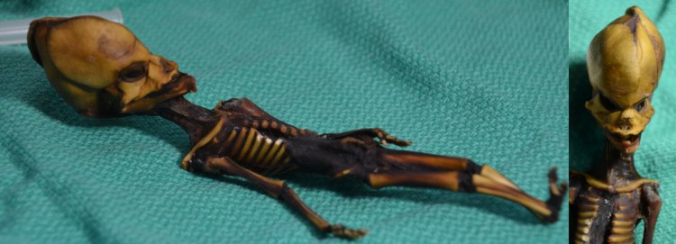 The Atacama skeleton, or Ata, named after the Chilean desert where the remains were found, has 10 pairs of ribs.