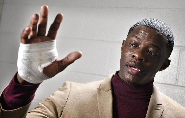 James Shaw Jr. shows his hand that was injured when he disarmed the gunman inside a Waffle House on Sunday.
