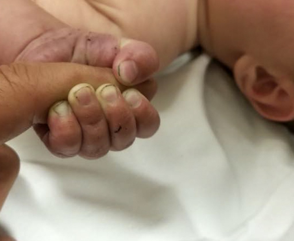 Dirt is visible under this baby's fingernails after he was pulled from underneath sticks and debris in Montana woods.