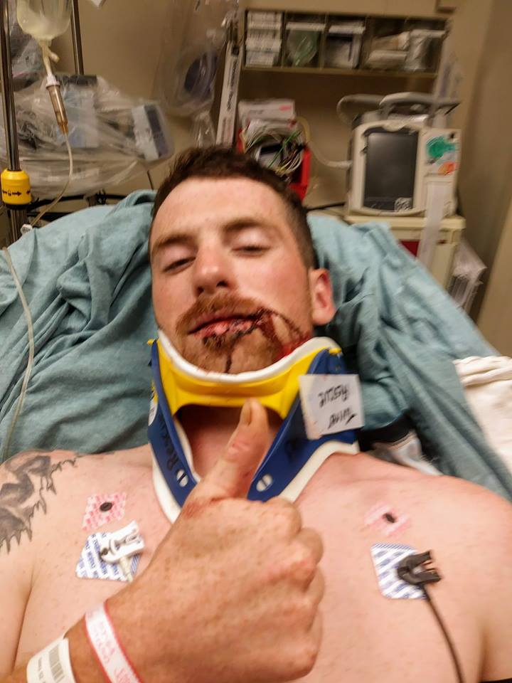 Cameron Hart is shown in his hospital bed after being hit in the face by a ricocheting bullet while he was playing disc golf in Turner.