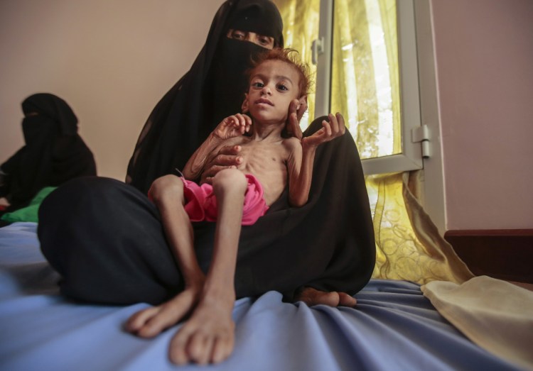 A woman waits with her malnourished son at the Aslam Health Center, in Hajjah, Yemen, last year. Thousands of Yemeni civilians have been displaced by a civil war. One of the factions is being supported by Saudi Arabia.
Associated Press/Hani Mohammed