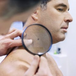 A white man in his forties has a mole on his neck examined by a dermatologist.