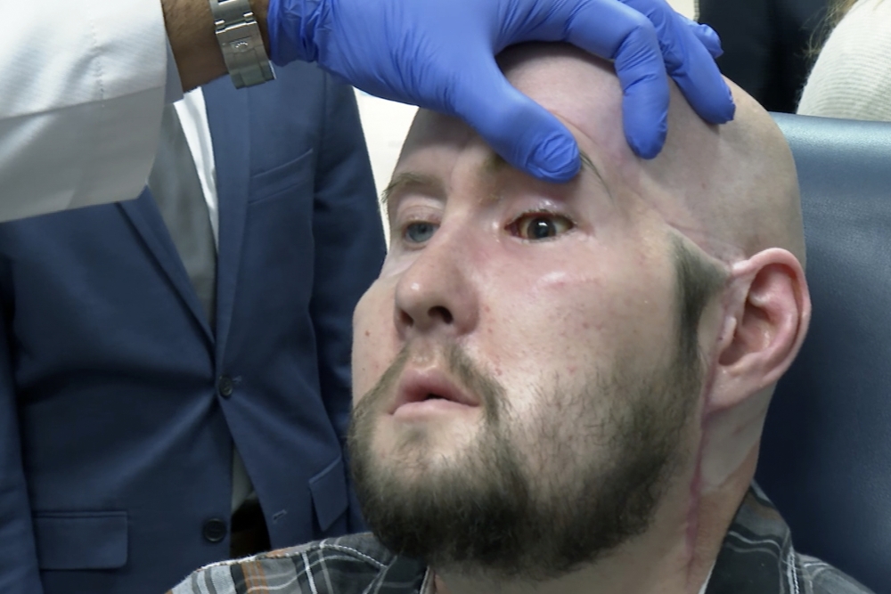 Arkansan becomes second person to receive neural-enhanced